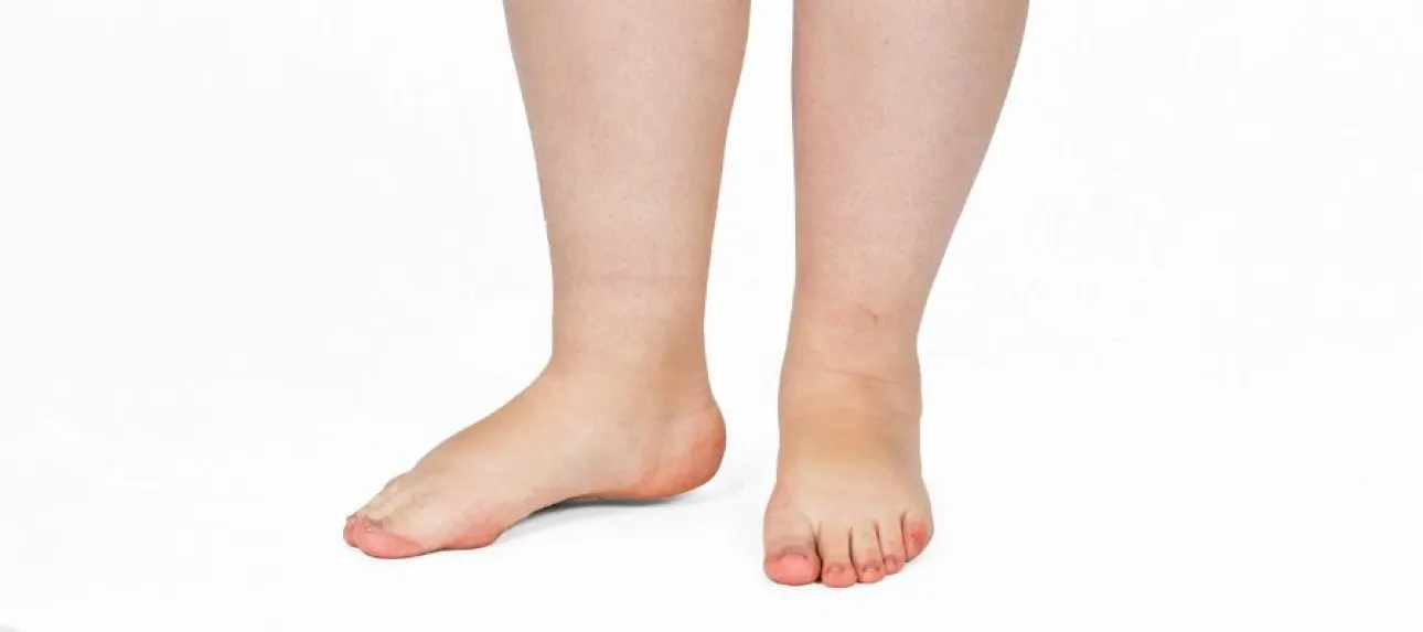 remede de grand mere pour les pieds gonfles