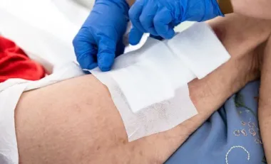 comment soigner un escarre